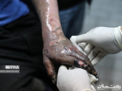حوادث چهارشنبه سوری در گیلان ۱۳۰ مصدوم برجا گذاشت